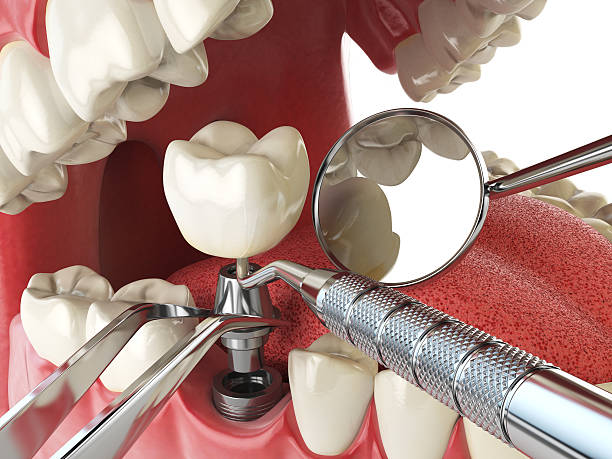 Best Broken or Chipped Tooth Repair in Shippensburg University, PA